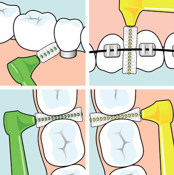 TePe Angle - 0,4 - 6 kos/paket